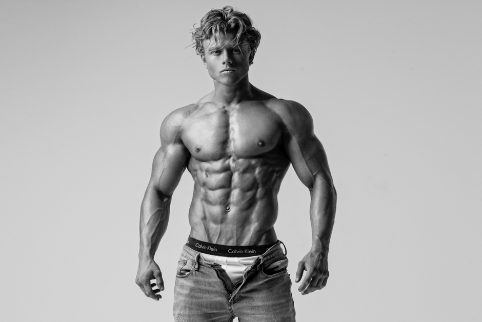 Diabetic-Bodybuilder-Aidan-Broddell